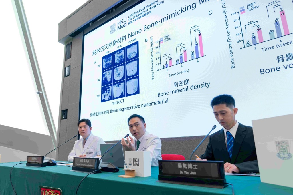 A novel elastic calcium phosphate material developed by HKUMed researchers, offers a promising alternative to traditional bone grafts in orthopaedic surgeries. The research team members include (from left) Professor Wong Tak-man, Professor Kelvin Yeung Wai-kwok and Dr Wu Jun. A novel elastic calcium phosphate material developed by HKUMed researchers, offers a promising alternative to traditional bone grafts in orthopaedic surgeries. The research team members include (from left) Professor Wong Tak-man, Professor Kelvin Yeung Wai-kwok and Dr Wu Jun.