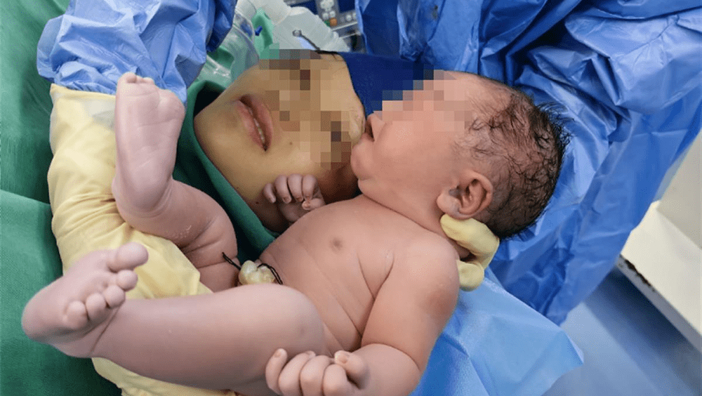Situs inversus is a rare birth defect in which the organs in the chest and abdomen are reversed or mirrored from their normal position. Situs inversus is a rare birth defect in which the organs in the chest and abdomen are reversed or mirrored from their normal position.