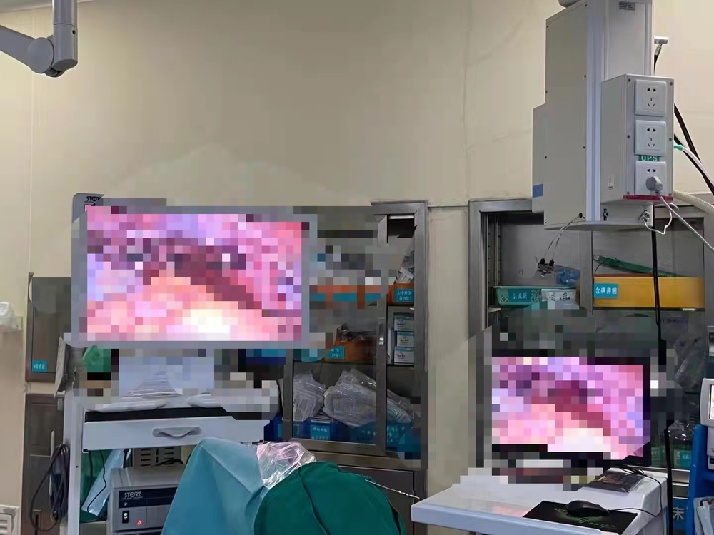 The student uploaded surgery images on WeChat while interning at a Chinese medicine hospital in Guangzhou. The student uploaded surgery images on WeChat while interning at a Chinese medicine hospital in Guangzhou.