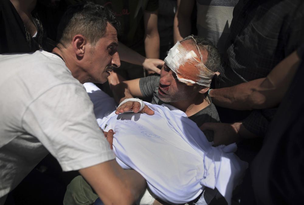 A injured Palestinian man mourns over the body of his young son, who was killed in overnight Israeli airstrikes, in Gaza City, Sunday, May 16, 2021.
