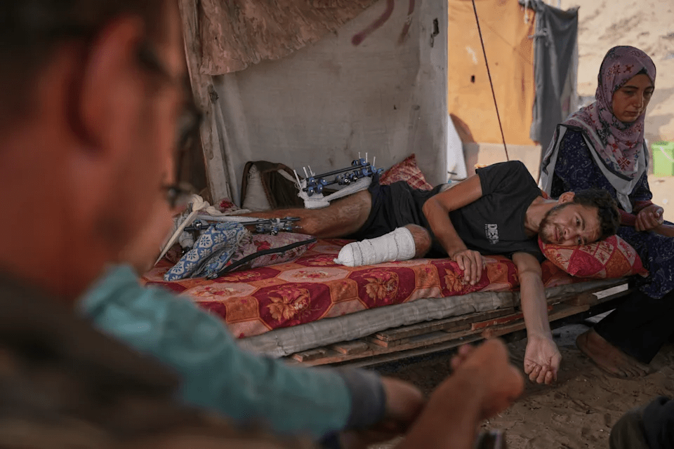 Yassin Marouf, 23, who lost his left foot and suffered a severe injury to his right leg after being hit by Israeli shelling in May, lies in a tent surrounded by his family in Zawaida, central Gaza, Thursday, Nov. 6, 2025. (AP Photo/Abdel Kareem Hana)