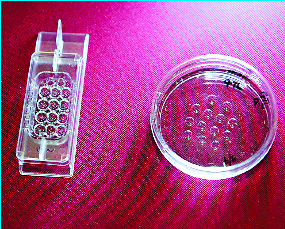 An IVF embryo dish used in TLI system, far left, and that of conventional method. An IVF embryo dish used in TLI system, far left, and that of conventional method.