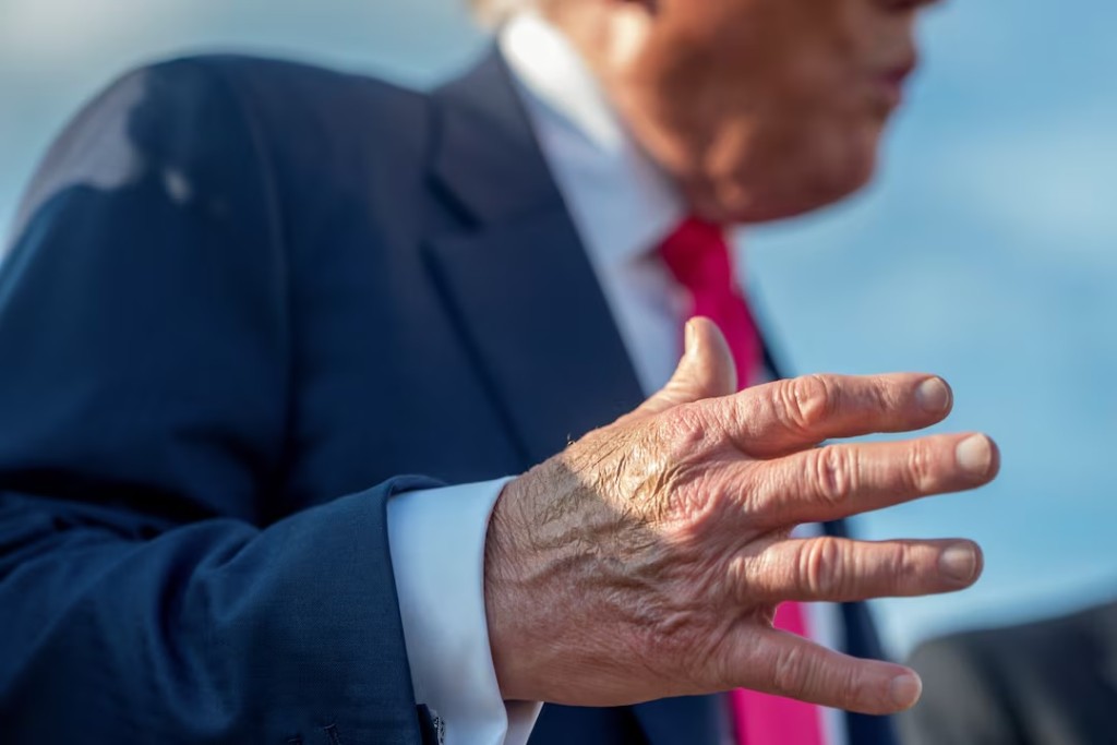 Make-up partially covers the back of the right hand of U.S. President Donald Trump as he speaks to members of the media upon his arrival from Pennsylvania, at Joint Base Andrews, Maryland, U.S., July 15, 2025. In a July 17, 2025 press briefing, U.S. Press Secretary Karoline Leavitt read a statement from his doctor that President Trump has a chronic venous insufficiency". (REUTERS)