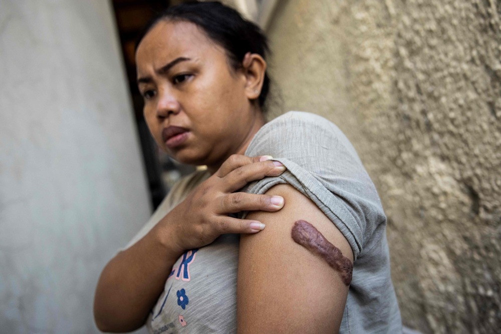 Indonesian domestic worker wins compensation for abuse in Hong Kong