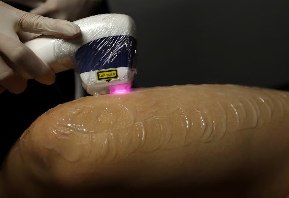 Yuki Kubo, 24, receives a leg hair removal treatment at Gorilla Clinic, a men's beauty clinic, in Tokyo, Japan August 19, 2026. REUTERS/Issei Kato