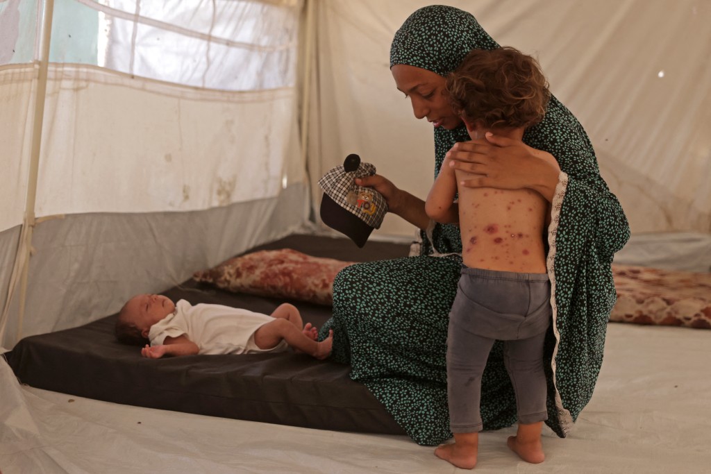 Photo by BASHAR TALEB / AFP A displaced Palestinian girl, who according to doctors is suffering from chickenpox, stands next to her mother inside the family's tent in Khan Yunis, in the southern Gaza Strip, on July 19, 2026.