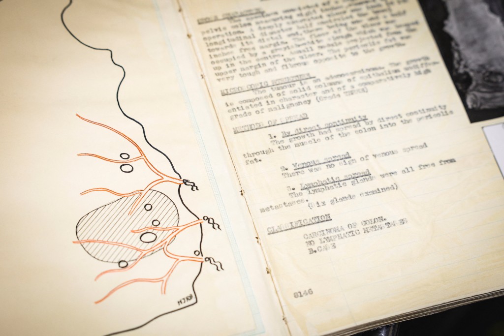 Photo by ADRIAN DENNIS / AFP  This photo taken on January 14, 2026 shows a diagram and notes which were typed into a notebook following surgery from the 1930s, kept in a storeroom at St Mark’s hospital at Northwick Park in Harrow, west London.