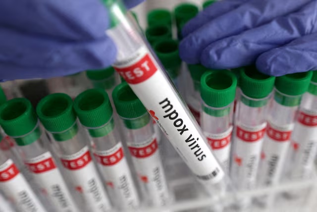 A test tube labelled 'Mpox virus positive' is held in this illustration taken August 20, 2024. REUTERS/Dado Ruvic/Illustration/File Photo A test tube labelled 'Mpox virus positive' is held in this illustration taken August 20, 2024. REUTERS/Dado Ruvic/Illustration/File Photo