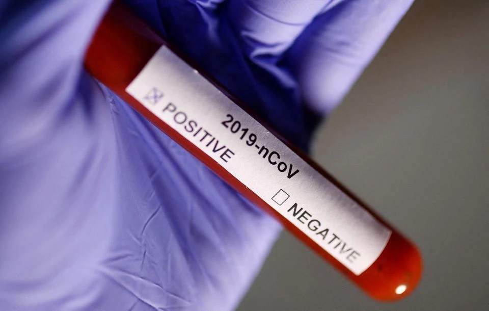 Test tube with Coronavirus label is seen in this illustration taken on January 29, 2020. (Reuters) Test tube with Coronavirus label is seen in this illustration taken on January 29, 2020. (Reuters)