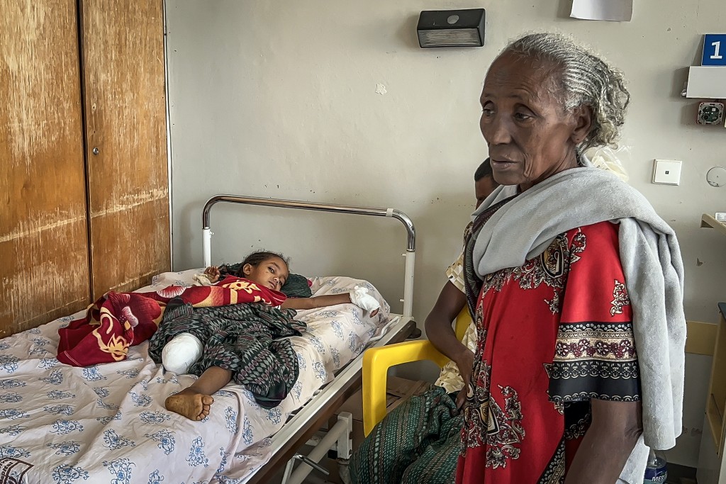 Lomo, 6, lies on a hospital bed next to family members at Ayder Referral Hospital in Mekelle on October 6, 2026 after suffering injuries that led to the amputation her leg, following heavy artillery shelling in Garjalle village.