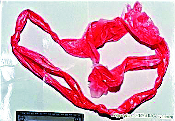 The knotted plastic tablecloth used to strangle the 21-year-old son three years ago. The knotted plastic tablecloth used to strangle the 21-year-old son three years ago.