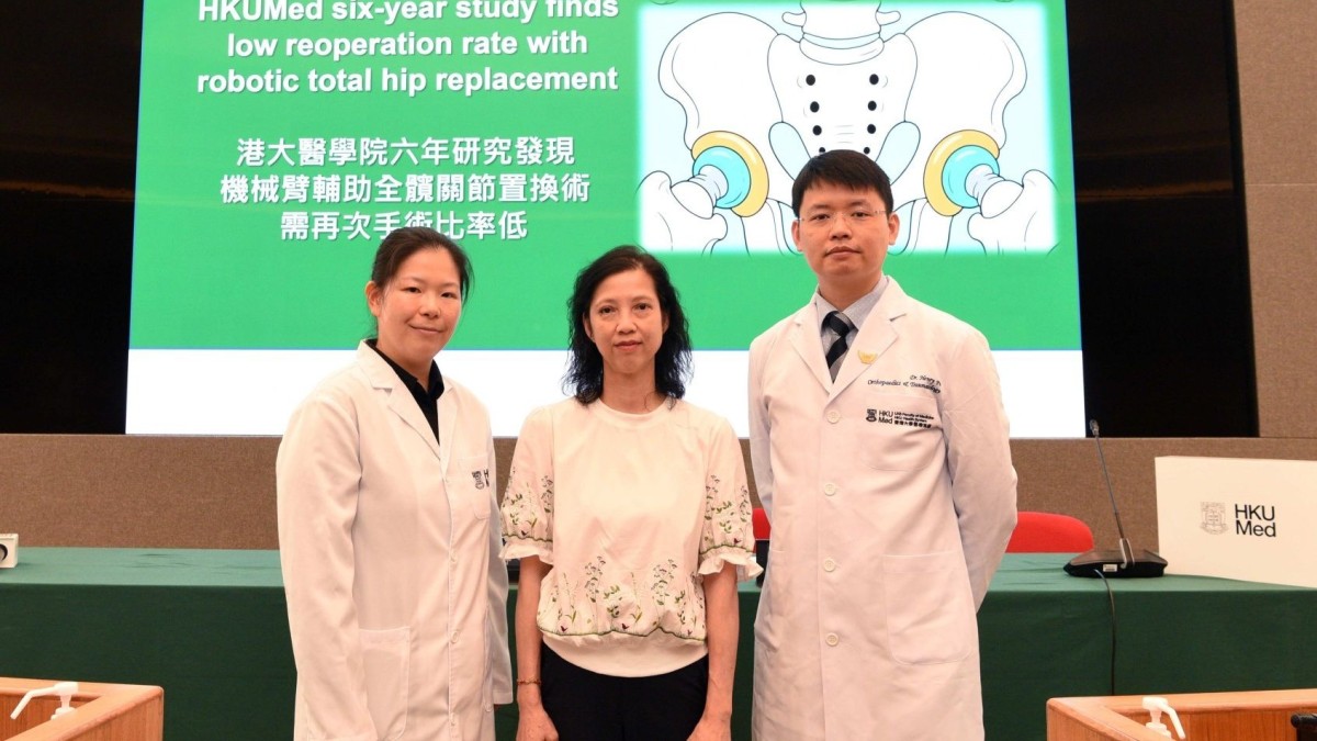thestandard.com.hk - The Standard 英文虎報 - Robotic-assisted hip replacements cut reoperation rates, HKU study finds