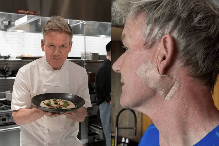 Gordon Ramsay reveals skin cancer diagnosis, highlights sun safety